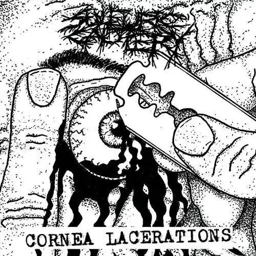SULFURIC CAUTERY / サルフュリック・カウテリー / CORNEA LACERATIONS (7")