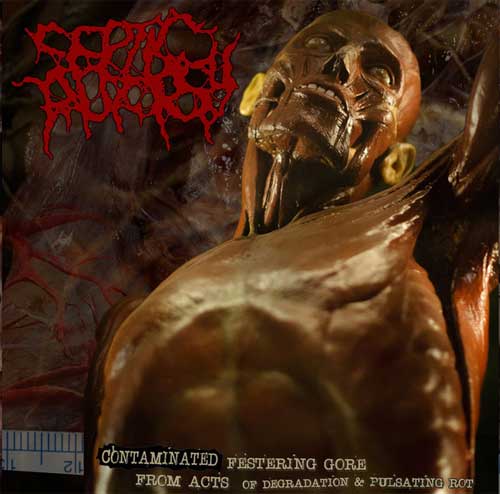 SEPTIC AUTOPSY / CONTAMINATED FESTERING GORE FROM ACTS OF DEGRADATION & PULSATING ROT