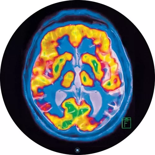 FRANKEY & SANDRINO / フランキー&サンドリノ / BRAINSCAN
