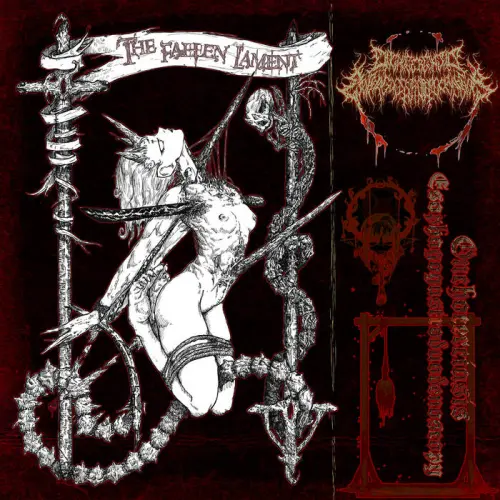 ONCHOCERCIASIS ESOPHAGOGASTRODUODENOSCOPY / THE FALLEN LAMENT