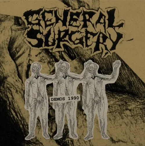 GENERAL SURGERY / ジェネラル・サージェリー / DEMOS 1990 (SOLID BLACK VINYL)