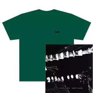 SHIBAKI / シバキ / NORMAL CONDITION  ★ユニオン限定T-SHIRTS付セットMサイズ 