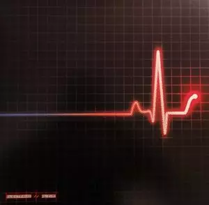 ⁄ PSYCHOBILLY ELEKTRAWS ELEKTRAWSレコード サイコビリー Strikes