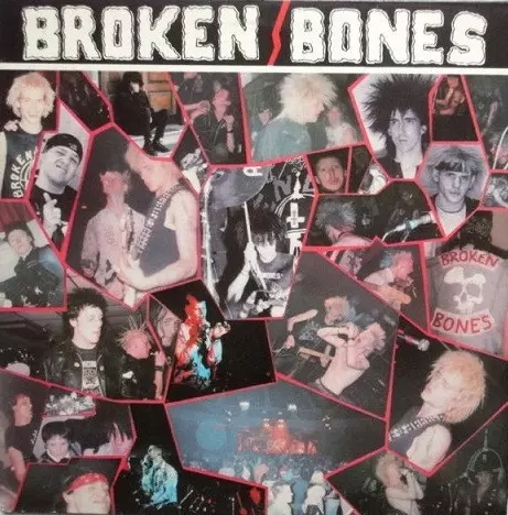 BROKEN BONES / NEVER SAY DIE