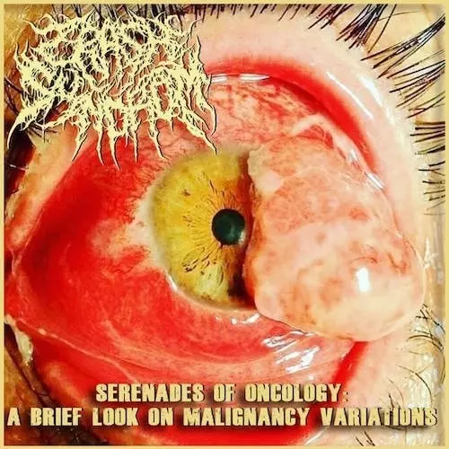 SPLIT (CRASH SYNDROM / CANNIBE) / SPLIT (CRASH SYNDROM / CANNIBE) 