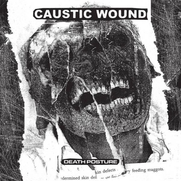 CAUSTIC WOUND / DEATH POSTURE