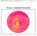EARTH / アース / EXTRA - CAPSULAR EXTRACTION